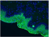 BM2298P - Cytokeratin 10