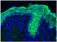 BM2298P - Cytokeratin 10