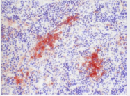 BM4017B - CD205 / DEC-205