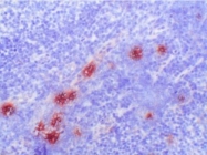 BM4026B - S100A9 / Calgranulin-B / MRP14
