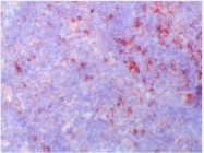 BM4054B - CD120b / TNFR2