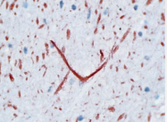 BM4078 - Neurofilament H (200 kD)