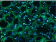 BM4502 - Lamin-B2 (LMNB2)