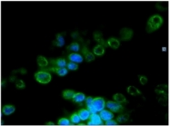 BM4502 - Lamin-B2 (LMNB2)