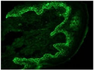 BM5048P - Cytokeratin 14