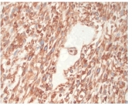 BM5050S - Vimentin