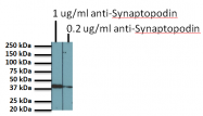 BM5086P - Synaptopodin / SYNPO