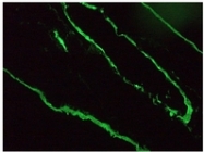 BM6005P - Cytokeratin 18