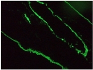 BM6005P - Cytokeratin 18