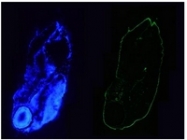 BM6005P - Cytokeratin 18