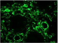 BM6008F - Vimentin
