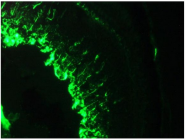 BM6008F - Vimentin
