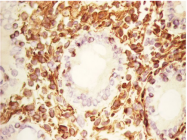 BM6008F - Vimentin
