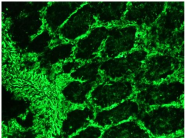 BM6008F - Vimentin