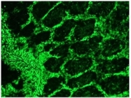 BM6008P - Vimentin