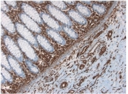BM6008P - Vimentin