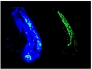 BM6008P - Vimentin