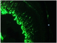 BM6008P - Vimentin