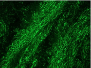 BM6011P - Neurofilament M (160 kD)