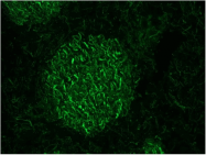 BM6011P - Neurofilament M (160 kD)