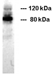 BM6016P - CD324 / Cadherin-1