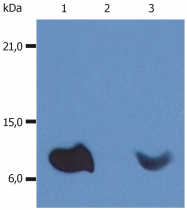 BM604F - Beta-2-microglobulin