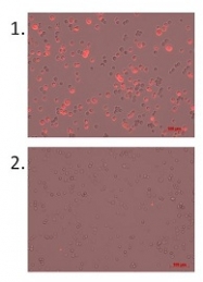 BM604S - Beta-2-microglobulin