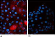 BM604S - Beta-2-microglobulin