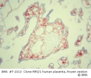 T-1013 - CD163