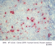 T-1016 - Macrophages