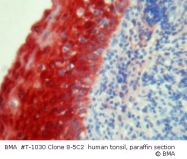 T-1030 - S100A8 / Calgranulin-A / MRP8