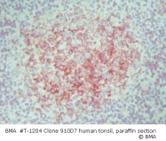 T-1204 - HLA Class II DR