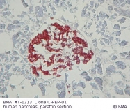 T-1313 - Insulin