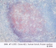 T-1355 - CD19