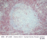 T-1365 - CD7