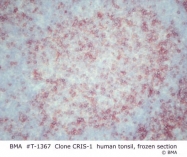 T-1367 - CD5
