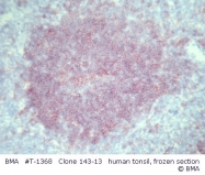 T-1368 - CD25 / IL2RA