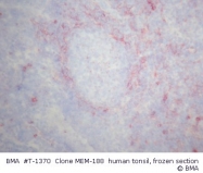 T-1370 - CD56