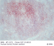 T-1371 - CD20