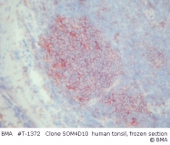 T-1372 - CD71 / TFRC