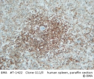 T-1422 - Interleukin-16 / IL16