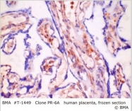 T-1449 - Progesterone receptor