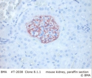 T-2038 - Podoplanin