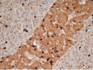 BP494 - Glucagon