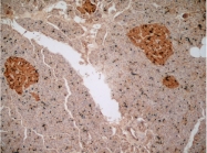 BP494 - Glucagon