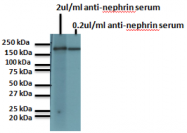 BP5030 - Nephrin