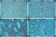BP5030 - Nephrin