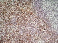 CL007P - CD8