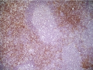 CL007P - CD8