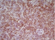 CL007P - CD8